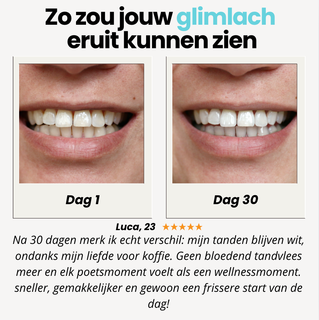 HyperMercaro™| Smart Toothbrush